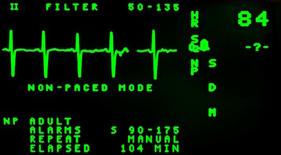 Electrocardiogramma salute rischio